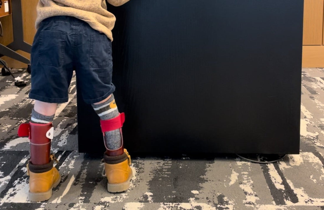 'What's Wrong with His Legs?'